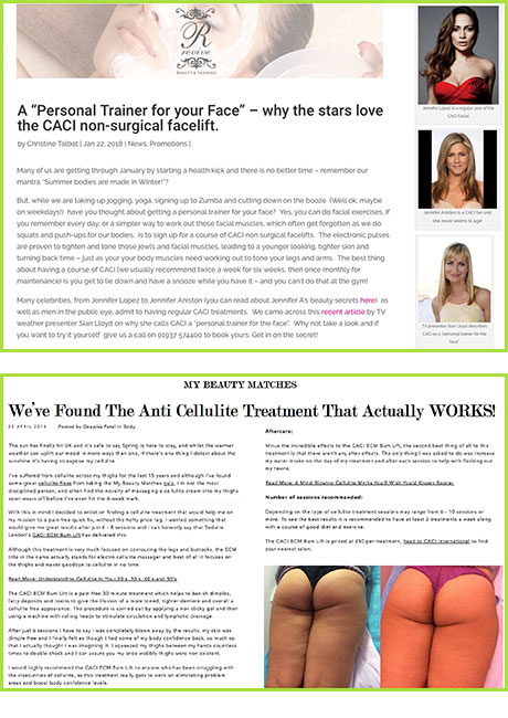 CACI Synergy Electro Cellulite Treatments